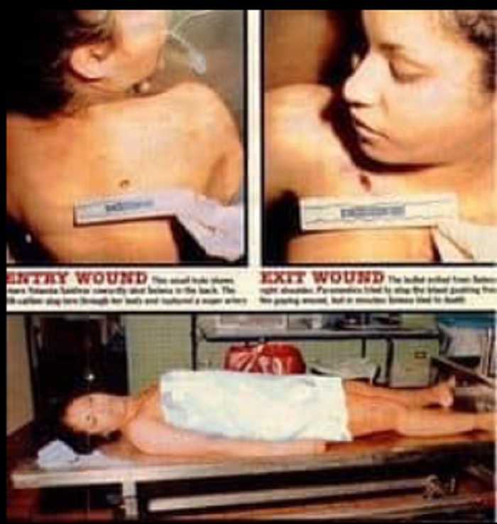 selena quintanilla autopsy